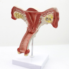 ANATOMY05 (12443) Modelo de Anatomia do Útero Feminino Mostrar Estruturas Genitais Femininas, Modelos de Anatomia&gt; Modelo de Anatomia Uterina